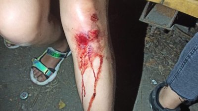 У Львові собака накинувся на дітей (ФОТО)