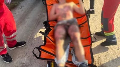 У Львові 13-річний хлопець робив селфі на вагоні потяга