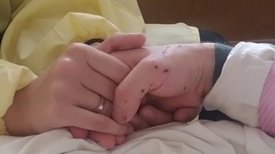 Український військовий і комік Віктор Розовий отримав осколкове поранення голови