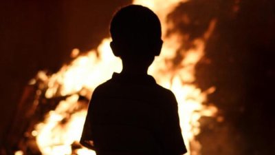 На Сокальщині під час пожежі чоловік отримав опіки