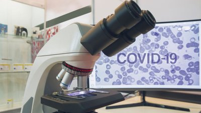 В Україні досліджують чотири препарати для лікування COVID-19, - МОЗ