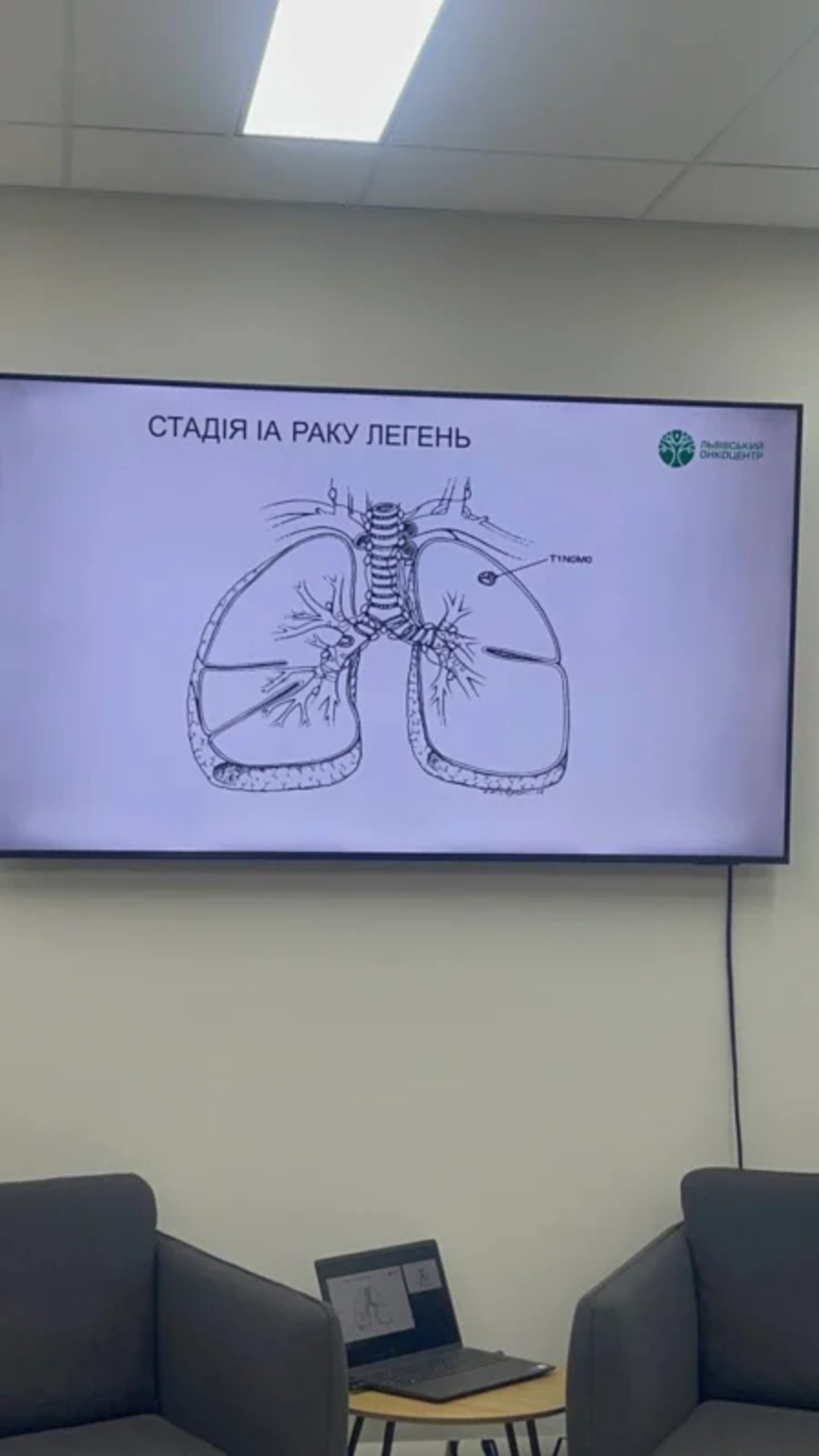 У Львівському онкоцентрі розповіли про рак легень, фото ОЛЕГ ДОВГАНИК, Четверта студія