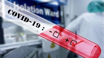 У Сокалі за добу з 56 протестованих методом ПЛР, у 51 особи виявили коронавірус