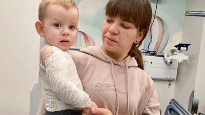 У Львові врятували малюка, який перекинув на себе чайник з окропом