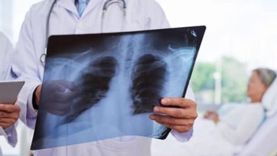 На Львівщині лікарю через смерть пацієнта загрожує до п'яти років позбавлення волі