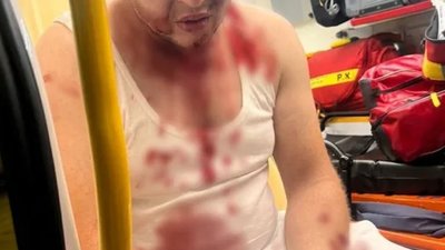 У Польщі біженцям розбили голови біля хостелу
