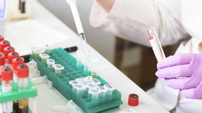Лікування ЗПСШ: сучасні методи та важливість ранньої діагностики