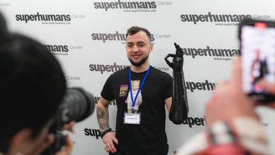 Двом українським воїнам, які втратили на війні руки, виготовили біонічні протези