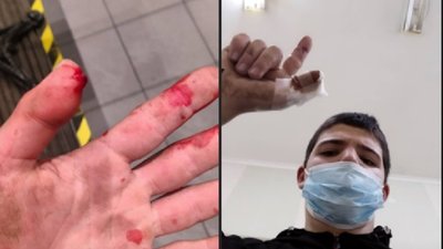 У Львові праворадикали з битами напали на екоактивіста