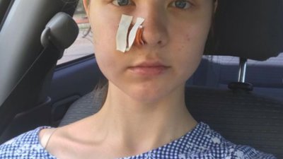 У резиденції президента “Синьогора” турист відкрив стрілянину в готелі і травмував відпочивальників (ФОТО)