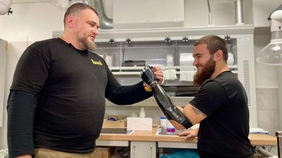 У Львові військовому із Маріуполя встановили біонічний протез (ФОТО)