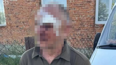 На Львівщині зять ножем поранив тещу (ФОТО)