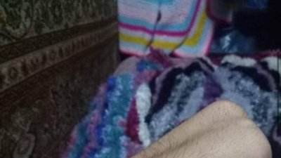 Співробітники Сумського обласного ТЦК визнали частково придатним до служби хлопця без кисті