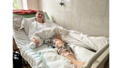 Львівські медики допомогли 18-річній дівчині повноцінно ходити