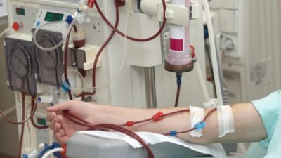 У львівській лікарні відкрили відділення дитячого гемодіалізу