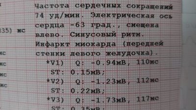 У Києві охоронці "Епіцентру" нібито силою роздягнули 67-річну жінку