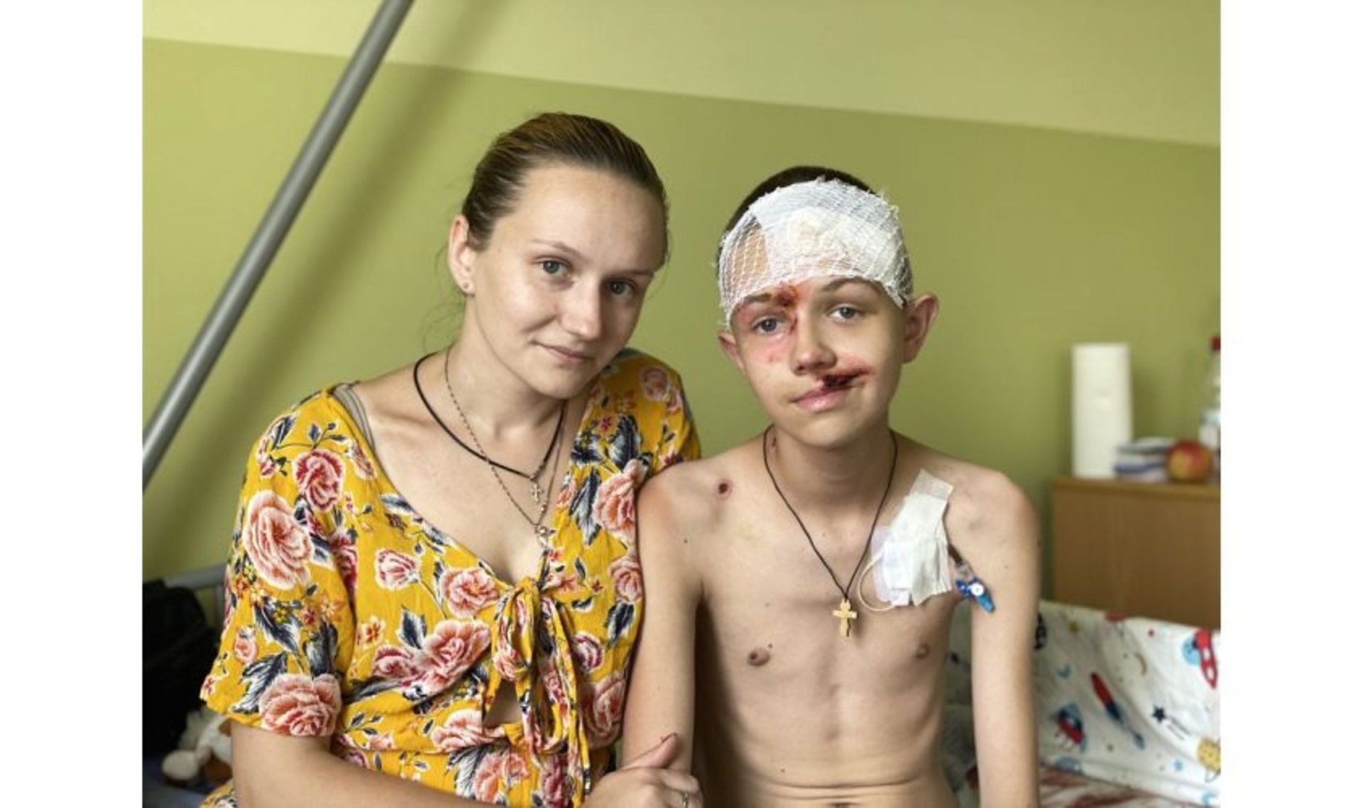 Уламок ракети пробив череп: львівські медики лікують 12-річного хлопчика з Харківщини