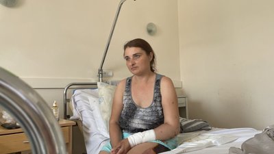 Львівські медики лікують жінку з Донеччини, яку через масивні травми ледь вдалося врятувати