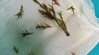 У львівському "Охматдиті" врятували 8-місячного хлопчика