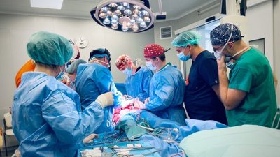 Лікарі Першого медоб’єднання Львова розділили печінку, щоб врятувати життя одразу двох пацієнтів