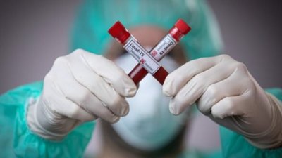 У Львівській області з COVID-19 73 людини перебуває на лікуванні у відділенні реанімації