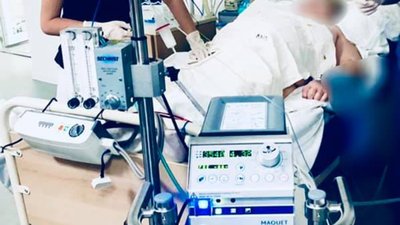 У Львові медики рятують важкохвору на COVID-19 жінку, сім’я якої є противниками вакцинації