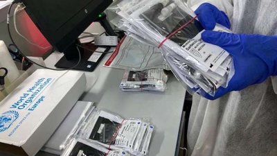 Львівщина COVID-19: за добу 172 хворих, троє пацієнтів померло
