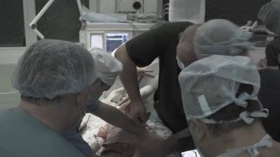 У Новояворівську 2-річній дитині м’ясорубка перемолола пальці (ВІДЕО)
