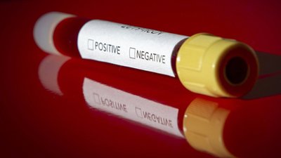 У Львові збираються заборонити  конференції і спортивні заходи