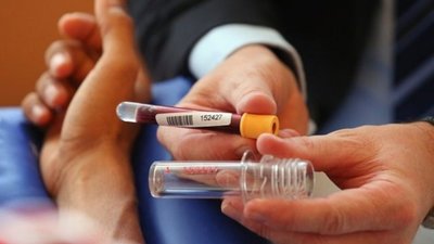 WADA знайшло докази вживання допінгу російськими спортсменами