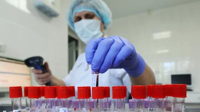 В Івано-Франківській області спалах коронавірусу на весіллі
