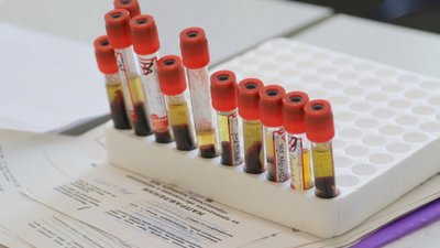 Для медиків передбачили страхові виплати у зв’язку з інфікуванням коронавірусною хворобою