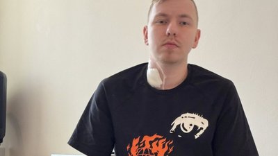 У Львові 23-річний чоловік потрапив у реанімацію