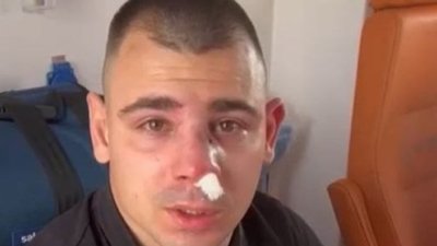 "Слуги народу" Дмитрук та Куницький побили хлопця в центрі Києва (ВІДЕО)