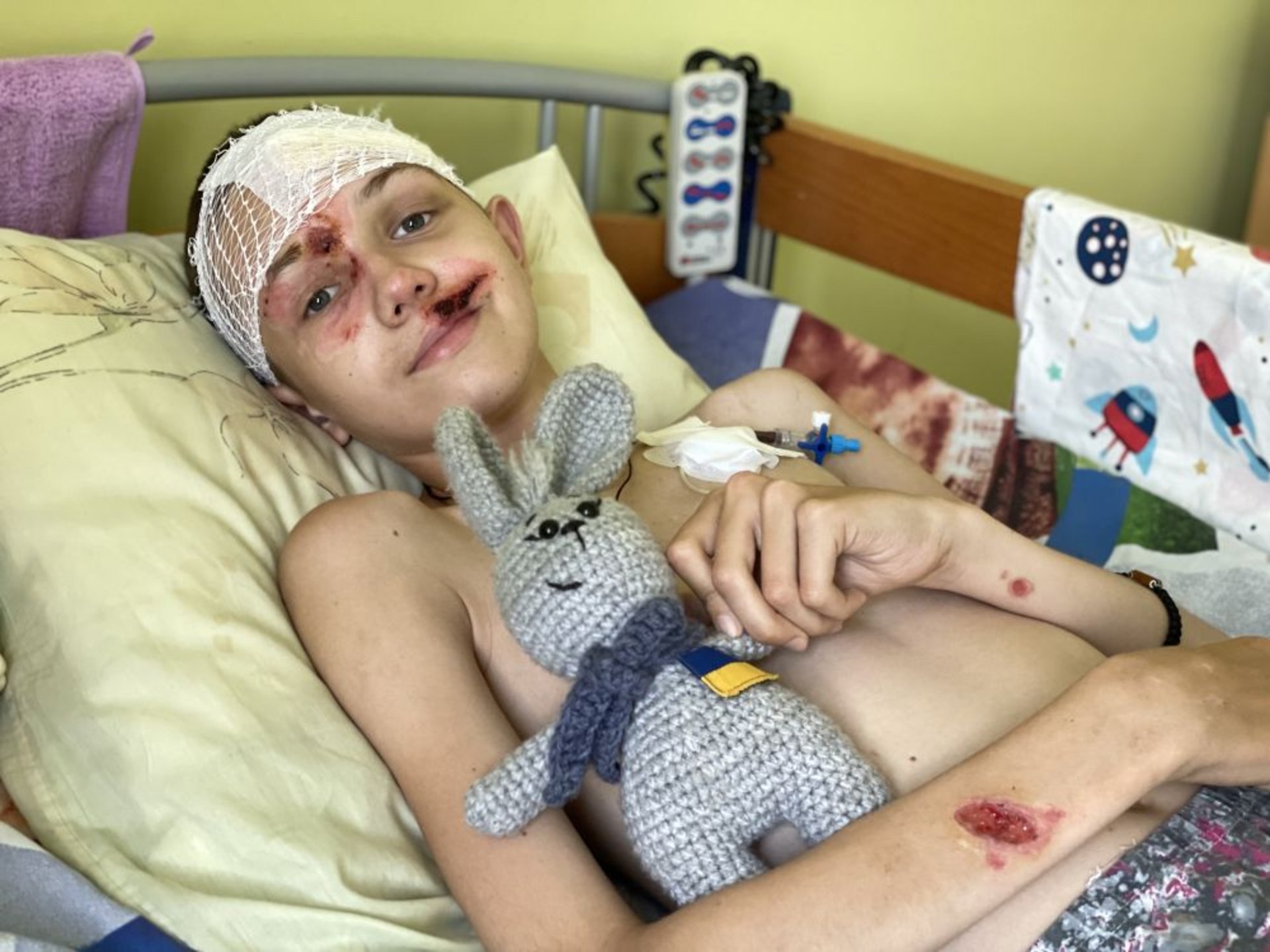 Уламок ракети пробив череп: львівські медики лікують 12-річного хлопчика з Харківщини
