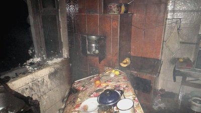 У Червонограді під час пожежі у літній кухні жінка отримала опіки обличчя