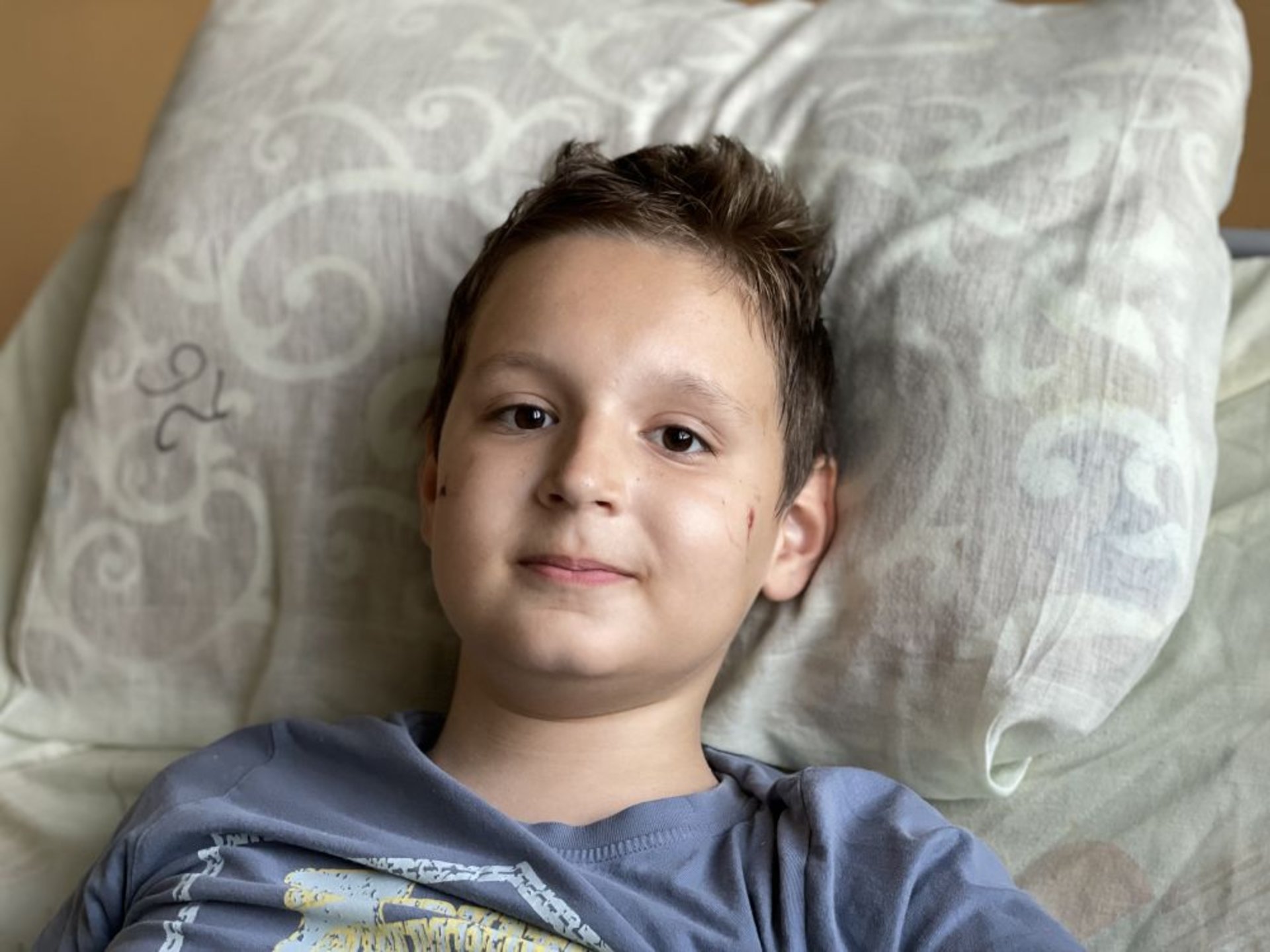 Львівські нейрохірурги врятували 11-річного хлопчика з Сєверодонецька, якого знерухомила пухлина
