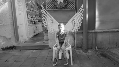 У Львові після видалення молочних зубів помер 5-річний хлопчик