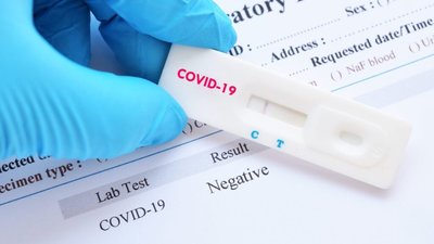 Туреччина з 30 грудня вимагатиме від туристів тести на COVID-19