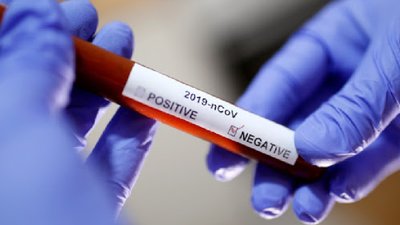 В Україні за минулу добу не зафіксували жодного нового випадку COVID-19,- ДСНС