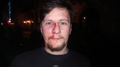 У Львові побили двох хлопців-ветеранів (ФОТО)