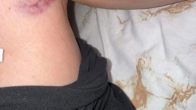 У пабі в центрі Львова через падіння дверей постраждала відвідувачка