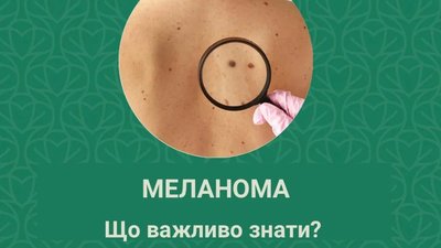 На Львівщині зафіксовано 34 нові випадки меланоми