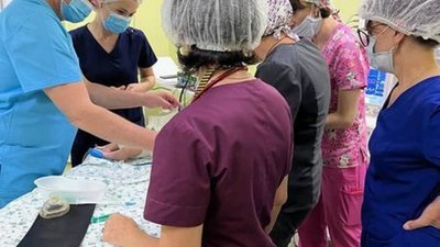 У дитячій лікарні «ОХМАТДИТ» відновили оперативні втручання дітям з ретинопатією недоношених