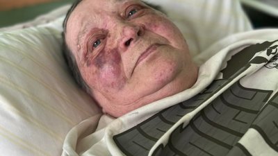 У Херсоні окупанти зламали хребет 70-річній волонтерці через відмову здати паспорт