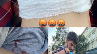 У Львові невідомий стріляв у вуличних музикантів