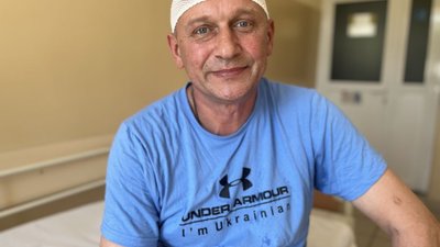 Львівські медики видалили гігантську пухлину мозку 53-річному чоловіку, який готувався їхати на фронт