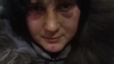 На Львівщині жорстоко побили та здійснили сексуальне насильство щодо сироти (ФОТО)