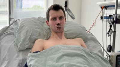 У Львові пересадили шкіру 30-річному захиснику