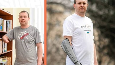 ​​Історії пацієнтів Superhumans Center: військовий Андрій Гідзун